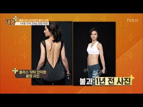 플러스 닥터 안지현, 20kg 감량 전 사진 공개! [내 몸 플러스] 51회 20170326
