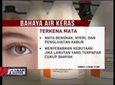 Pertolongan Pertama Jika Terkena Air Keras