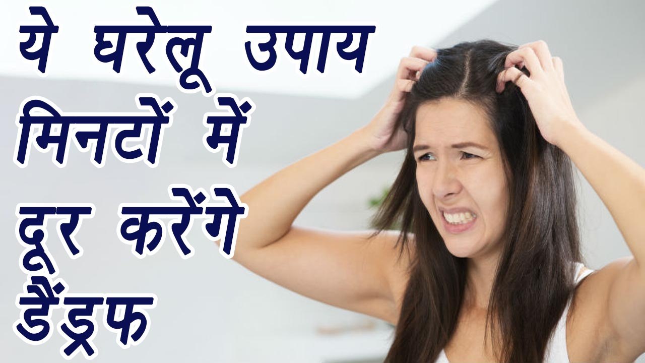 Dandruff treatment with home remedies, ये घरेलू उपाय मिनटों में दूर करेंगे डैंड्रफ | BoldSky