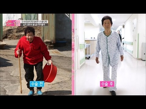 수술을 마친 순자엄마! 과연 허리 상태는? [엄마의 봄날] 81회 20170319
