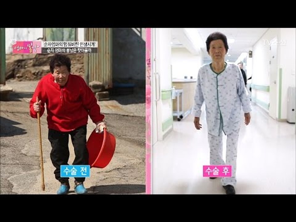 수술을 마친 순자엄마! 과연 허리 상태는? [엄마의 봄날] 81회 20170319