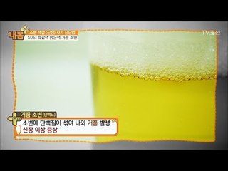 소변 색으로 알아보는 신장의 건강 [내 몸 플러스] 50회 20170319