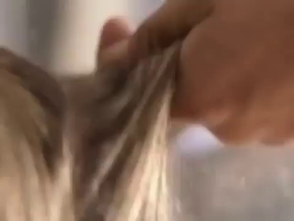 UK Hair Transplant Surgery: A Patients Journey: BBC Documentary