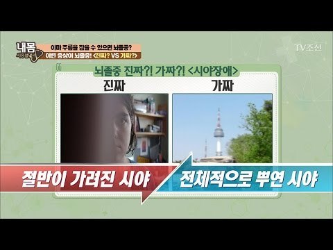 뇌졸중, 가짜와 진짜 구분법! [내 몸 사용설명서] 146회 20170317