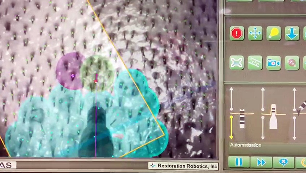 Suivi des prelevements_ROBOT ARTAS