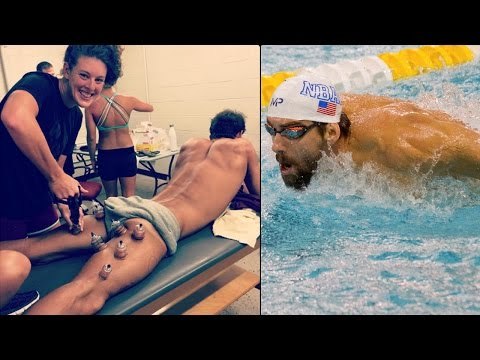 Michael Phelps has purple dots on his shoulder, Here's why - Mystery revealed | Oneindia News