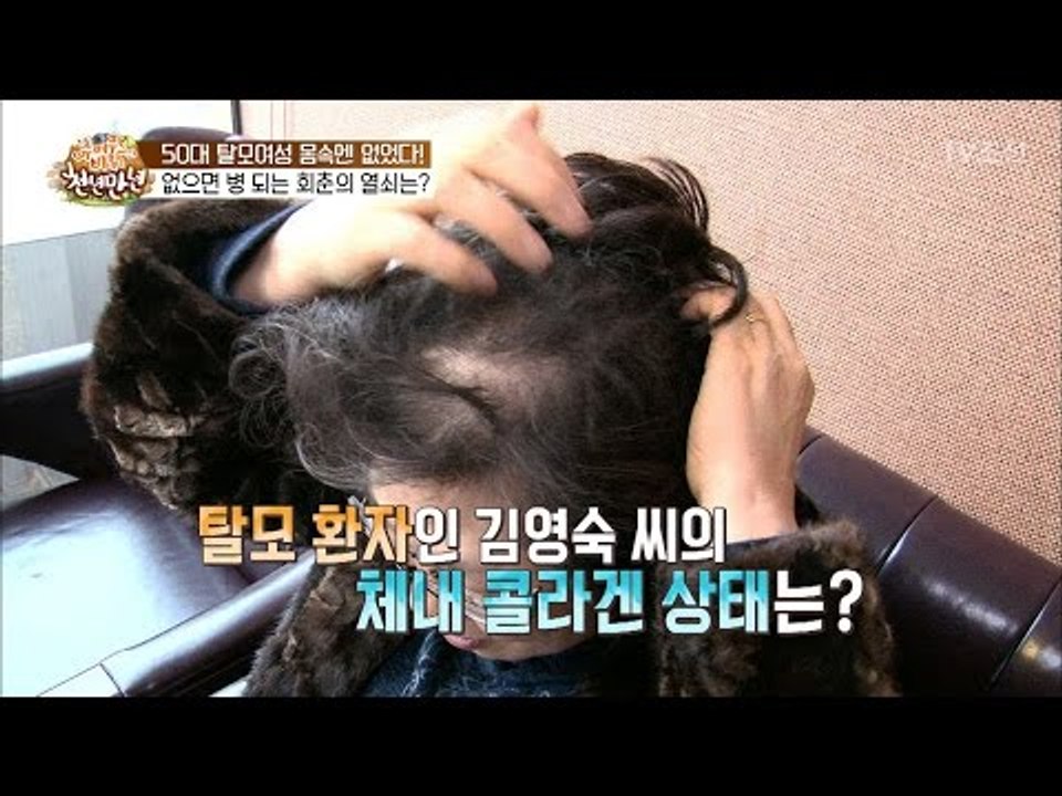 50대 탈모여성 몸속에 없었던 ‘이것’ [슈퍼푸드의 비밀 천년만년2] 7회 20170305