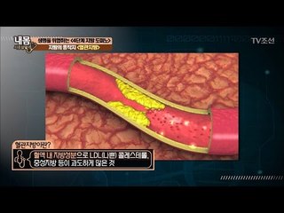 지방의 끝판왕! ‘혈관지방’의 위험도 [내 몸 사용설명서] 144회 20170303