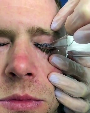 Ecco un motivo per cui i tatuaggi sulle palpebre sono una pessima idea!