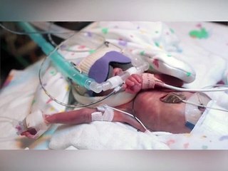 Njihuni me foshnjen qe lindi 3 muajsh e gjysme, ja si duket sot