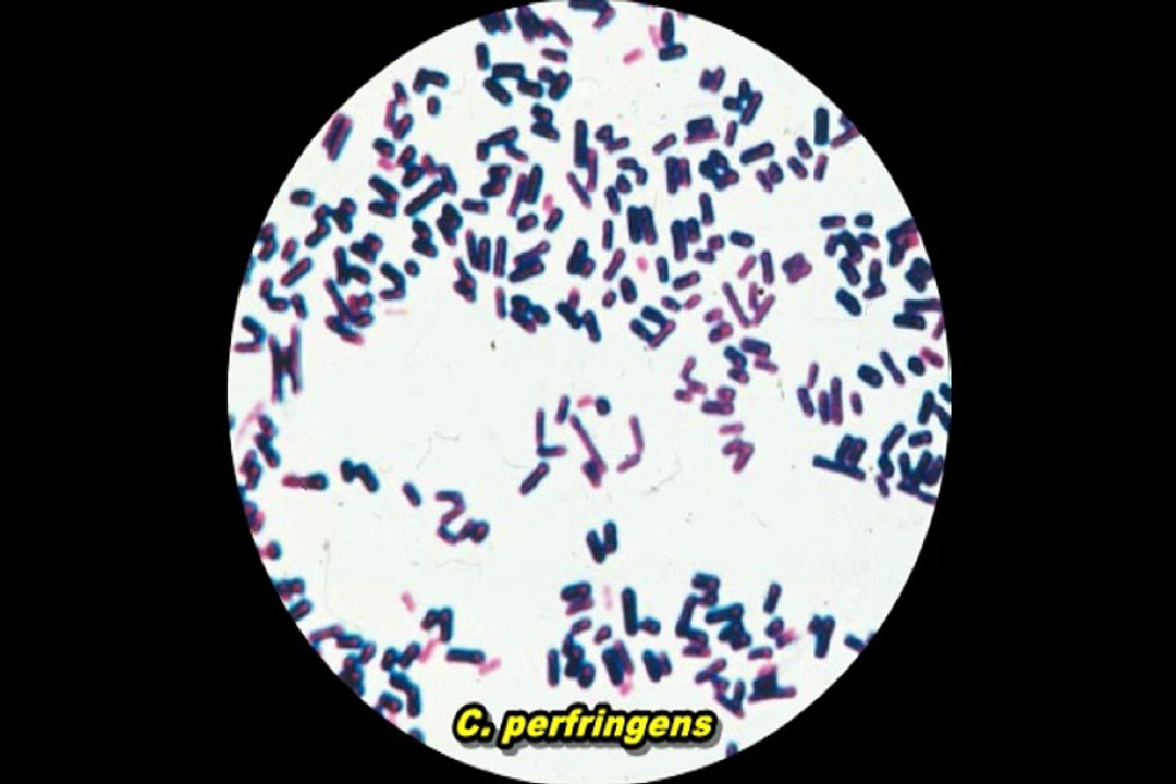 Atlas de microbiologia