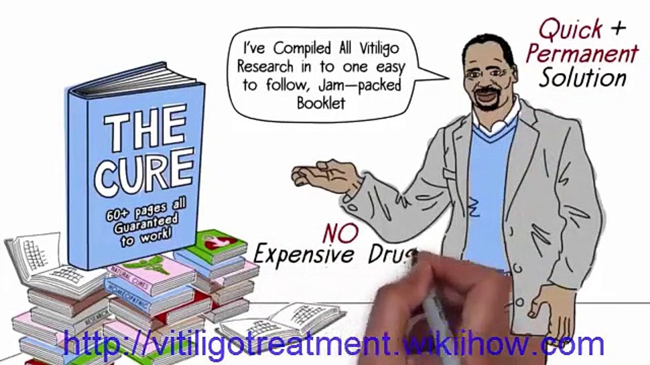 vitiligo cure 2017