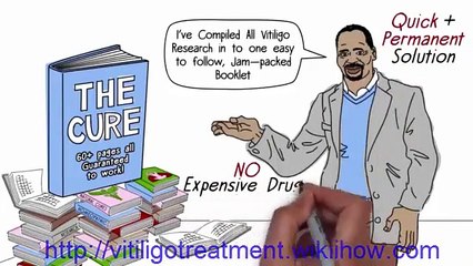 vitiligo guaranteed treatment