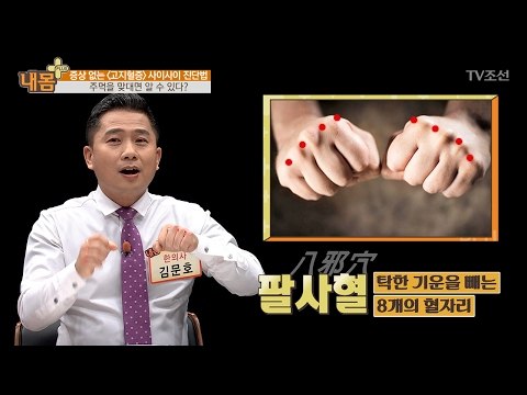 혹시 나도 고지혈증? 주먹으로 알아보는 자가 진단법! [내 몸 플러스] 45회 20170212