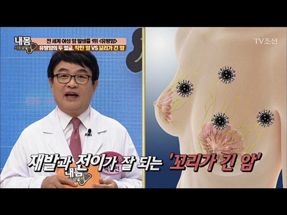 유방암의 두 얼굴, 착한 암? 꼬리가 긴 암? [내 몸 사용설명서] 141회 2017...