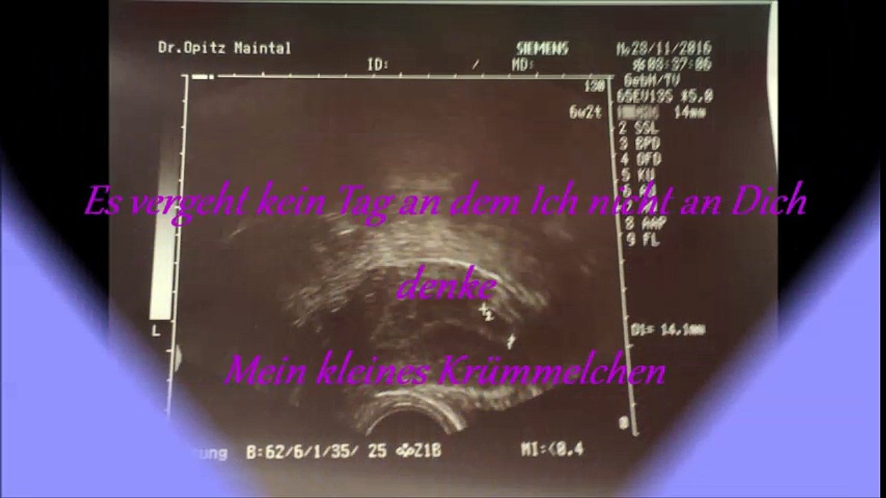 mein kleines Krümmelchen