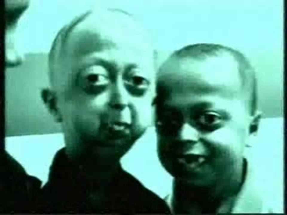 Choc enfants hindous malformés