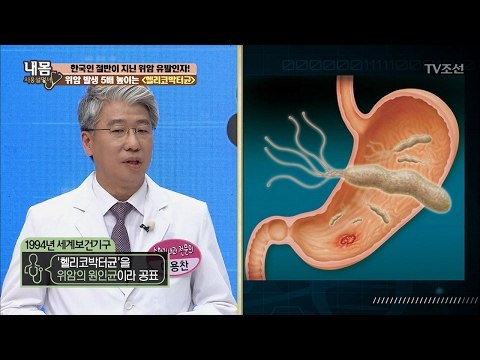 위암 발생 5배 높이는 ‘헬리코박터균’ [내 몸 사용설명서] 140회 20170203