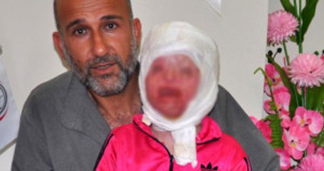 Suriyeli Minik Ayşe'nin Sağlığına Kavuşmak İstiyor