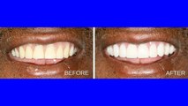 Brookhaven Dentist - Call 770-455-6602