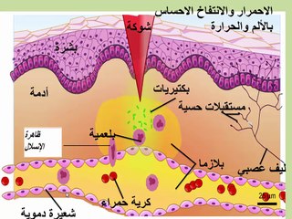 العلوم الطبيعية درس المناعة