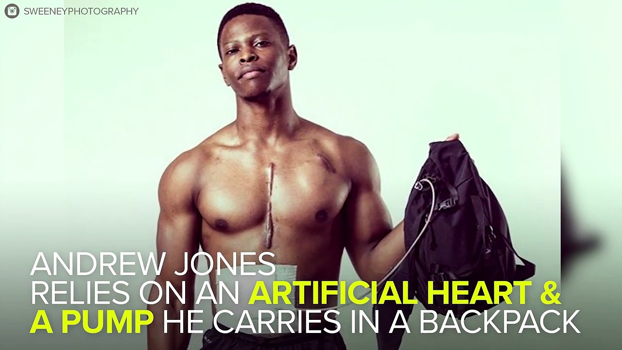 An Artificial Heart Won't Stop This Bodybuilder From Pursuing His Dream