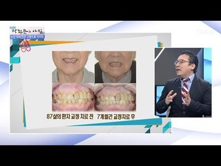 인상을 바꾸려면 교정 치료를 해라! [광화문의 아침] 407회 20170123
