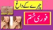Remove Dark Spots Acne Spot Freckles At Home In Urdu Beauty Tips In Urdu