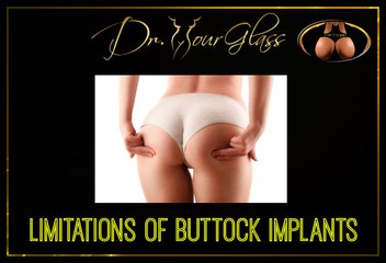 Limitations of buttock implants