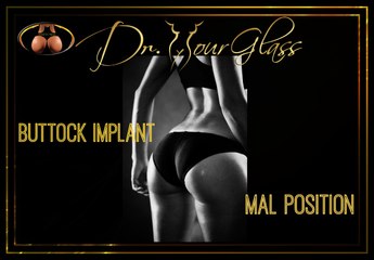 Understanding Buttock Implant Malpositions: Causes and Solutions 🍑