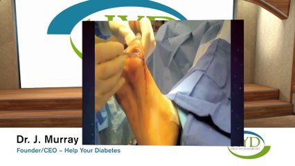 Help Your Diabetes Program: Tips to Reverse Neuropathy