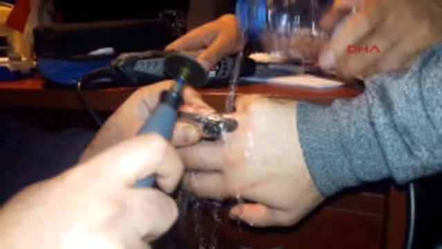 Kocaeli Parmağına Sıkışan Yüzüğü Itfaiye Çıkardı