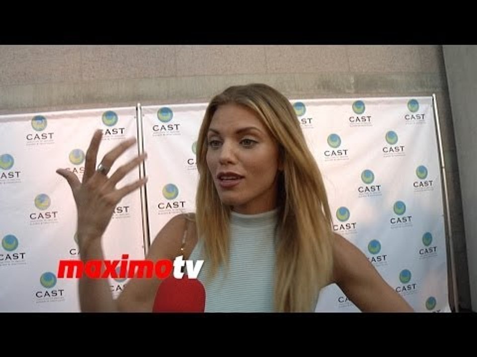 AnnaLynne McCord On Adult Acne, Food Allergies, Not Being Politically Correct