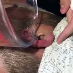 Il a une araignée coincée dans l'oreille ses amis l'aident à la faire sortir !