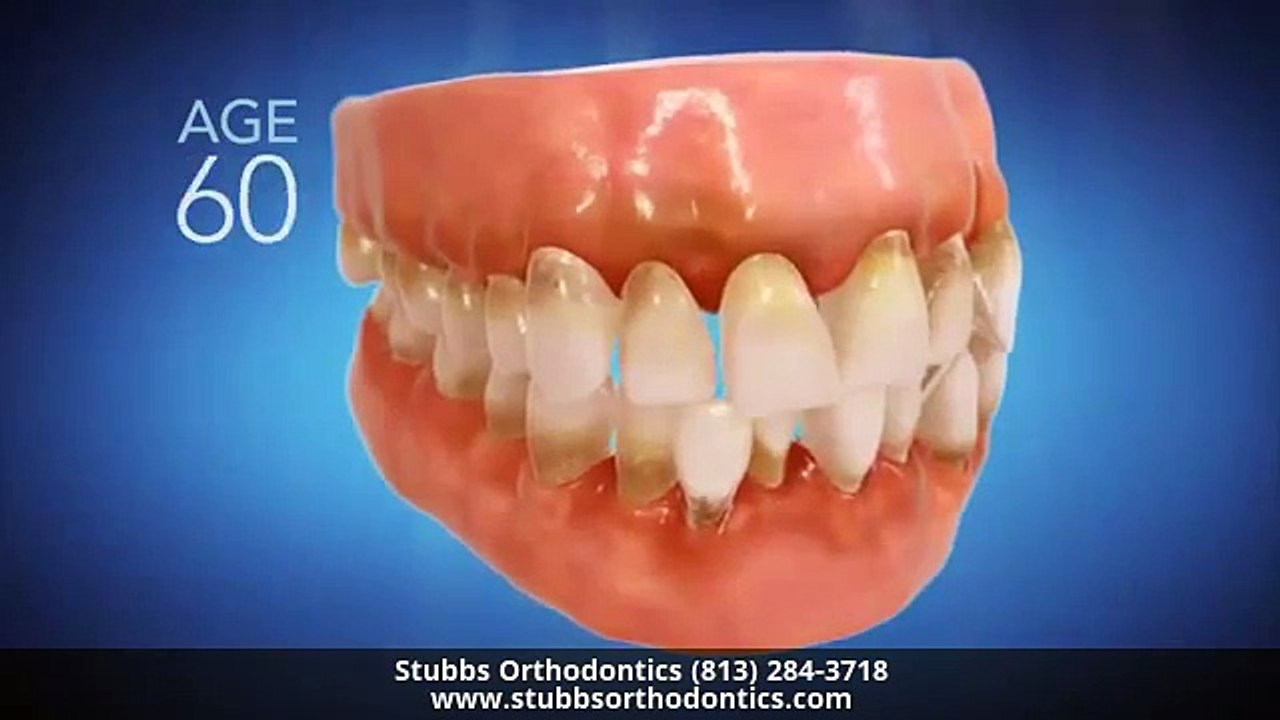 Invisalign Orthodontist Brandon FL