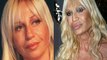 10 Worst Cases Of Plastic Surgery Gone Wrong : Before and After