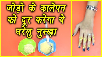 下载视频: Elbows, knees, finger joints का कालापन ऐसे करें दूर | Home Remedies