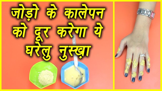 Elbows, knees, finger joints का कालापन ऐसे करें दूर | Home Remedies