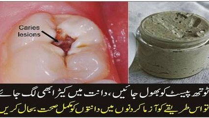 Best  Amazing Home Remedies for Yellow Teeth