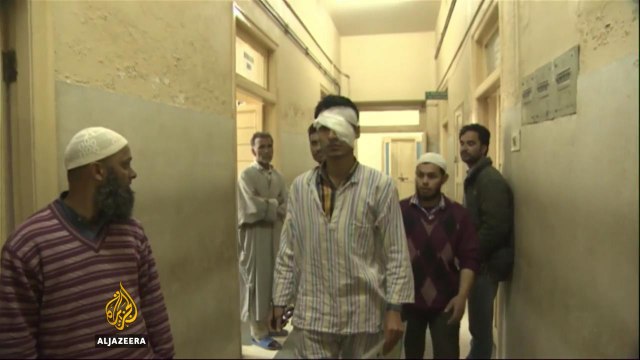 Pellet guns take toll on civilians in Indian-administered Kashmir