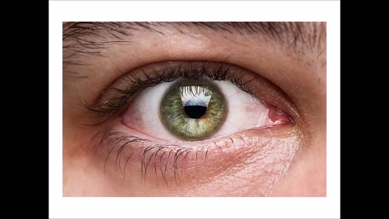 What is Glaucoma Really