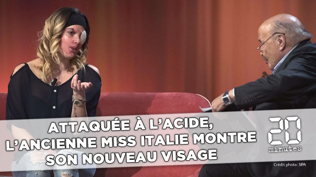 Attaquée à l'acide, l'ancienne Miss Italie 2007 montre son nouveau visage