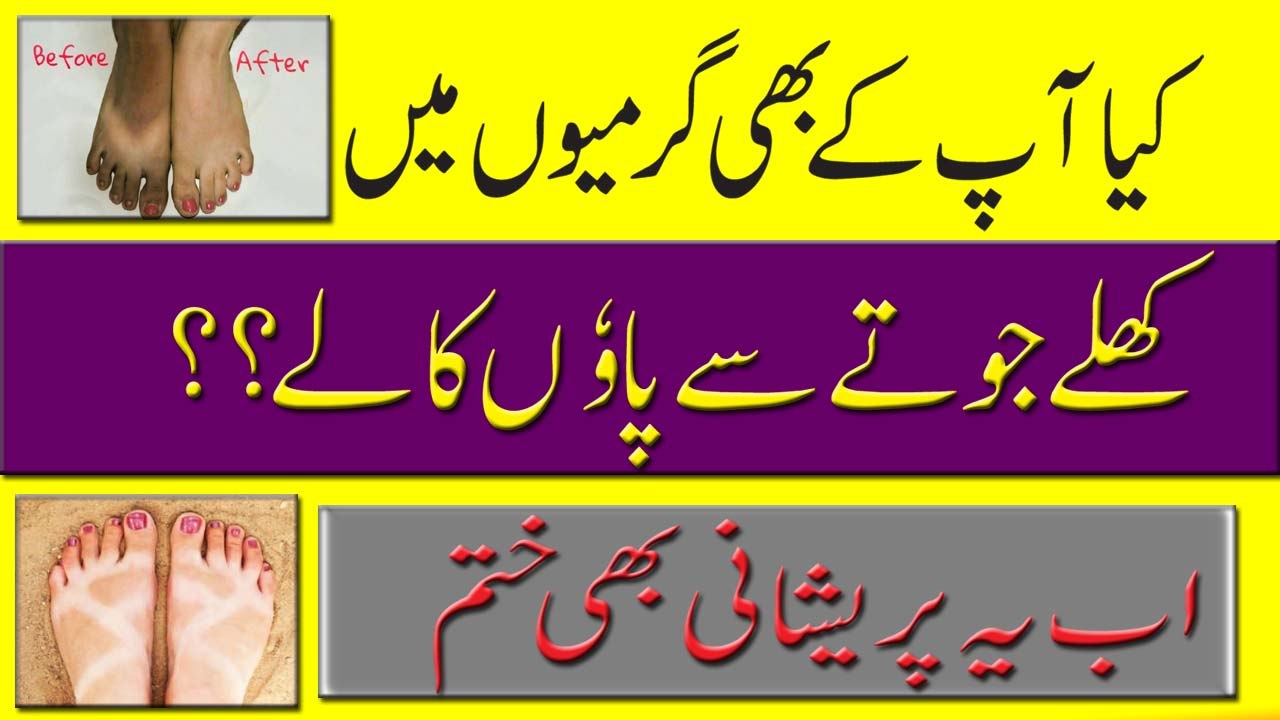 Sun Tan Removal Tips | How To Remove Sun Tan From Feet | Remove Sun Tan Quickly In Urdu Hindi