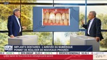 Les nouveaux progrès en matière d'implantologie dentaire grâce au numérique – 27/04