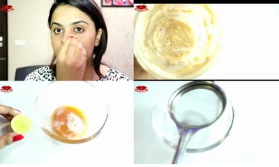How to Remove BLACK SPOTS , DARK SPOTS & ACNE SCARS on face _ONLY in 5 days