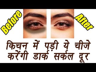 Dark circle home remedis, आंखों के काले घेरे दूर करेंगी किचन में पड़ी ये चीजें | BoldSky