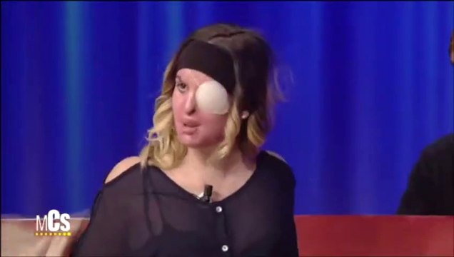 Le courage de Miss Italie 2007 qui dévoile son visage après son attaque à l’acide