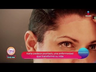 OJO si tienes resequedad en el cuero cabelludo