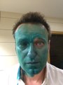 Navalny Attacked With Green Dye for Second Time