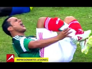 Las lesiones más impresionantes del futbol